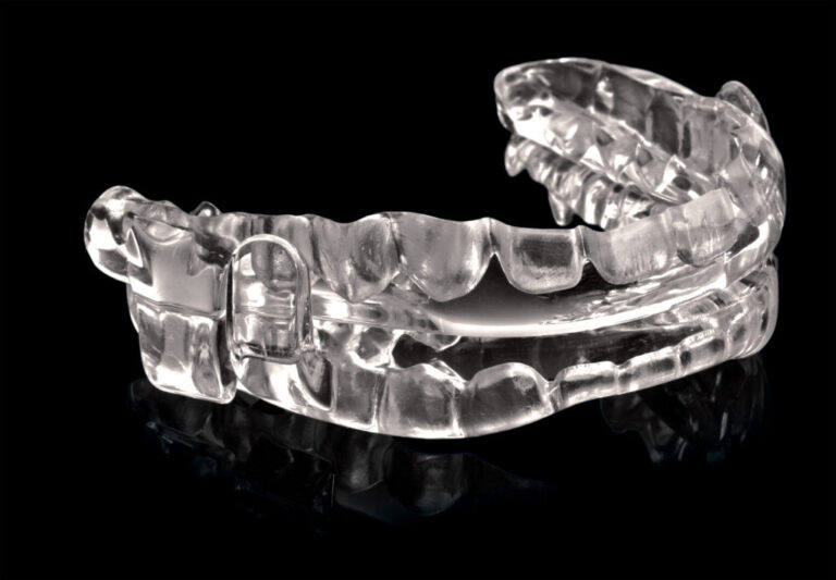 Mouth Guards for Sleep Apnea: An Overview